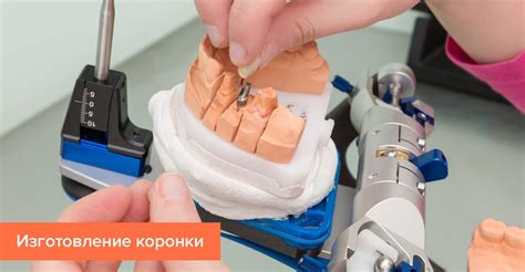 Изготовление коронки в лаборатории