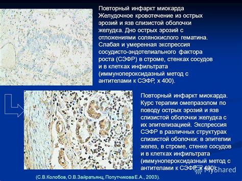 Изменение текстуры и цвета слизистой оболочки