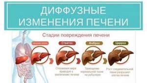 Изменения аппетита и расстройства пищеварения: возможные симптомы поражения гепатобилиарной системы