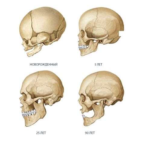 Изменения костей черепа