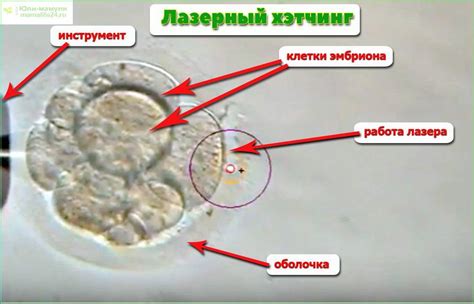 Инновационные технологии хетчинга эмбрионов