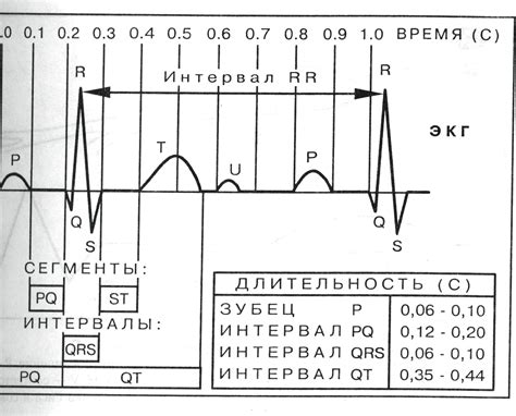 Интервалы и сегменты ЭКГ при динамическом контроле