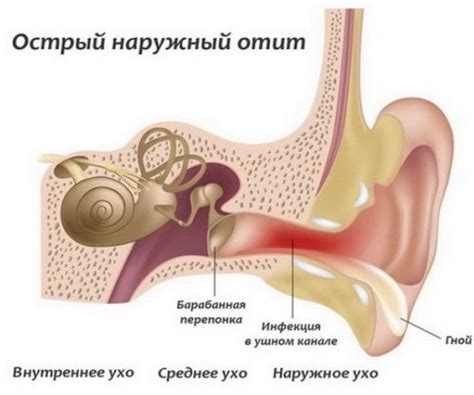 Какие другие заболевания могут проявиться как воспаление левого уха