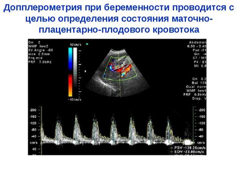 Какие преимущества доплерографического исследования?