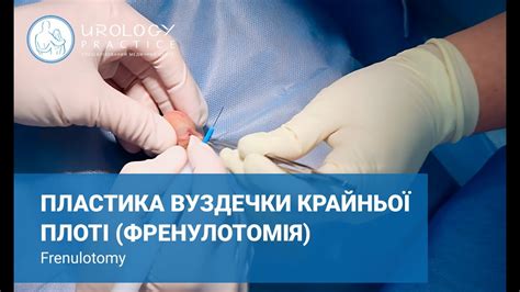 Какие проблемы могут возникнуть при короткой уздечке крайней плоти?