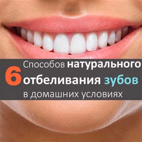 Какие существуют способы отбеливания в домашних условиях?