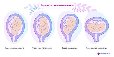 Какое влияние оказывает положение плода на результаты визуализации?