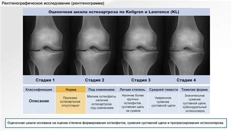 Как диагностировать болезни суставов?