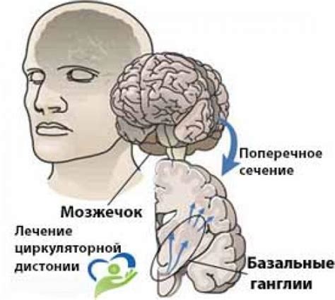 Как диагностировать кардиальный тип НЦД?