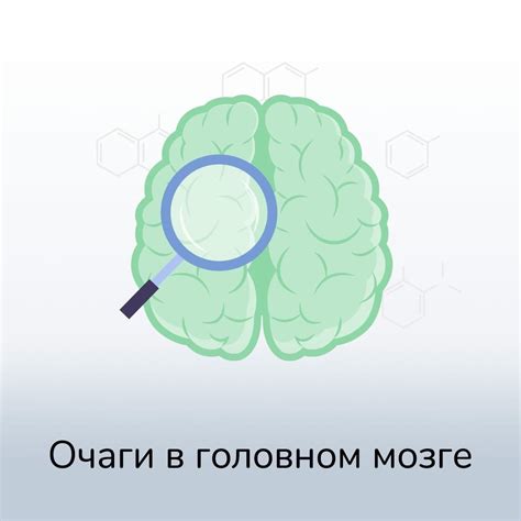 Как диагностировать эпи очаги в головном мозге