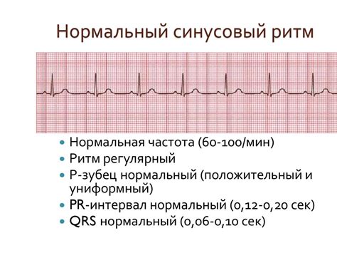 Как длительный синусовый ритм на фоне спокойной активности влияет на организм?