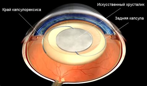 Как лечить зуд левого века