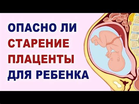 Как местоположение плаценты на уровне внутреннего зева влияет на развитие плода?