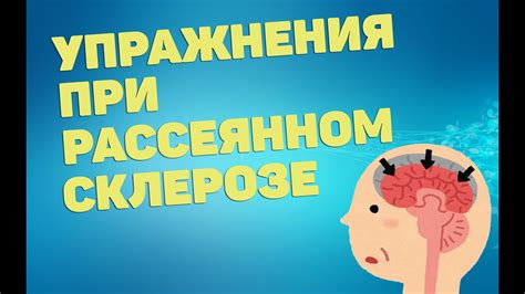 Как можно облегчить головокружение при рассеянном склерозе?