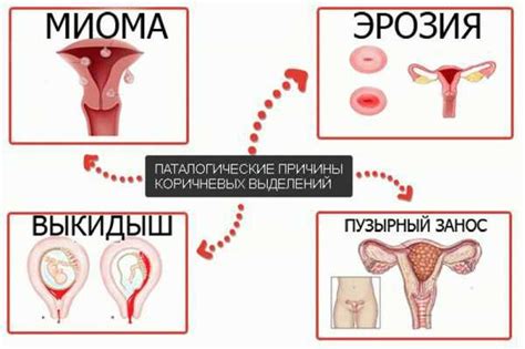 Как определить нарушения на основании выделений