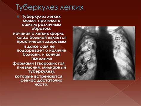 Как определить признаки поражения легких