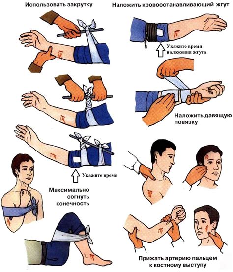 Как остановить кровотечение и оказать первую помощь