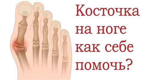 Как помочь организму избавиться от косточки