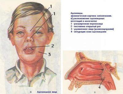 Как понять, что у ребенка заложен нос: основные признаки и помощь