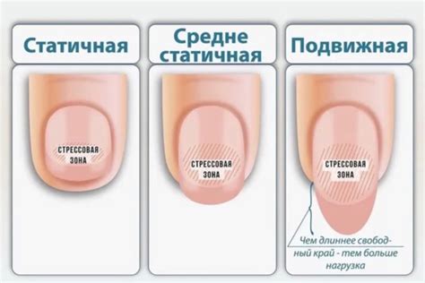 Как предотвратить дальнейшее повреждение ногтя