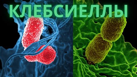 Как проводится диагностика Клебсиеллы у новорожденных?