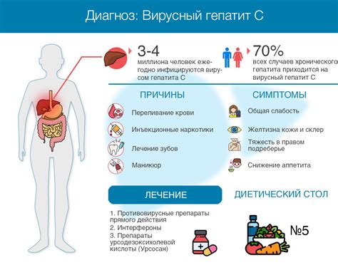 Как проводится лечение вискозипатии у мужчин?