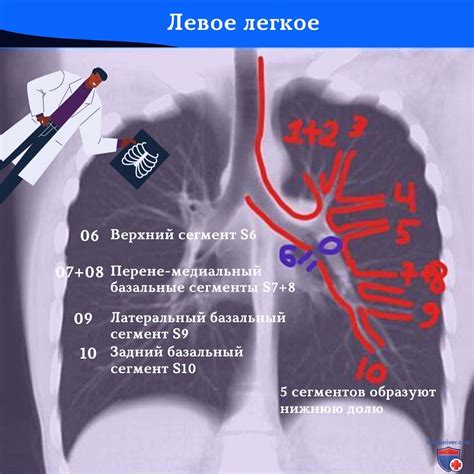 Как производится интерпретация округлых теней на рентгенограмме легких?