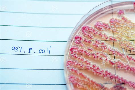 Как происходит заражение Escherichia coli?