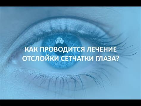 Как происходит лечение отслойки хориона