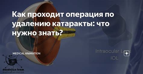 Как проходит операция по удалению капсулы?