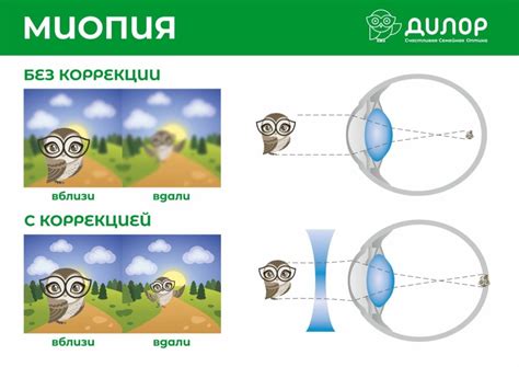 Как распознать миопию у подростка?