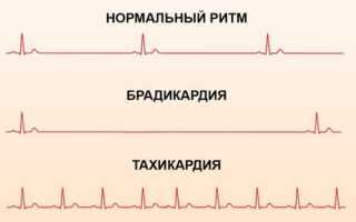 Как снизить пульс при низком давлении 90/70