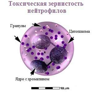 Как токсическая зернистость отражает работу иммунитета