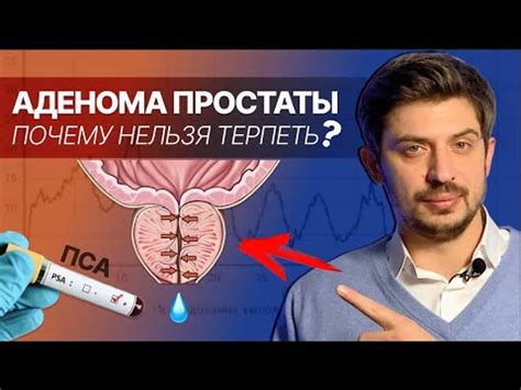 Когда нужно проводить обследование предстательной железы?