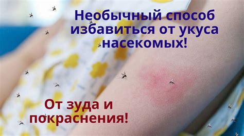 Когда обратиться к врачу при укусе мошки?