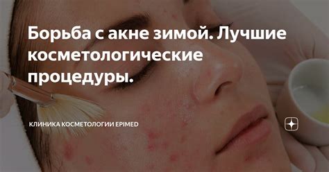 Косметика и процедуры для борьбы с акне