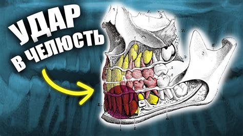 Кровоизлияния в челюсть