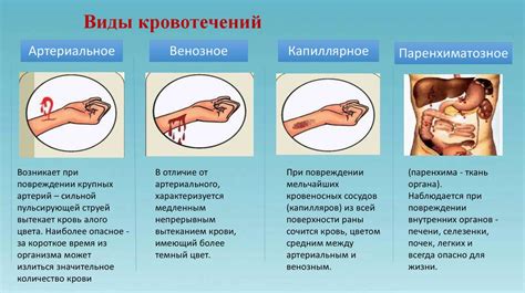 Кровотечение и его характеристики