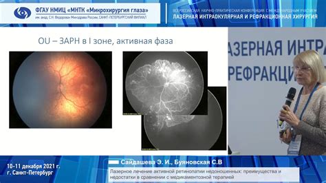 Лазерное лечение суставов: преимущества и результаты