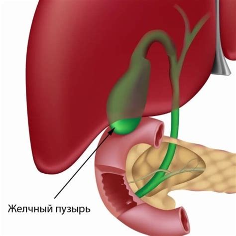 Лечение биломы ложа желчного пузыря