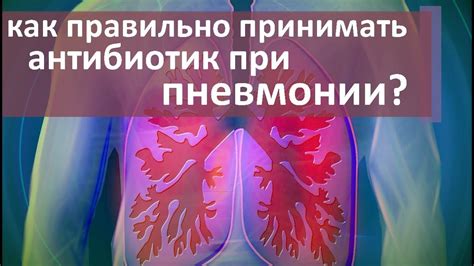 Лечение выпота при пневмонии