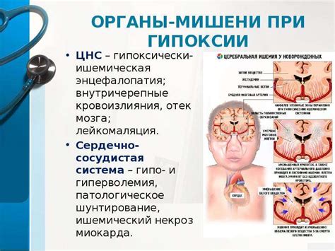 Лечение гипоксии головного мозга у ребенка