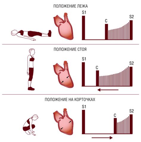 Лечение и профилактика систолического шума