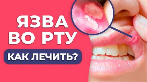 Медицинские причины появления пены во рту