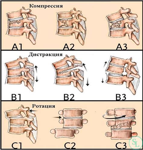 Методы диагностики и лечения гемангиолипом в телах позвонков