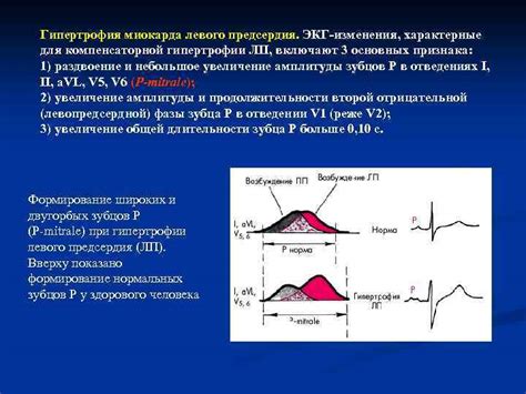 Методы диагностики состояния миокарда