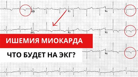 Методы динамического контроля ЭКГ