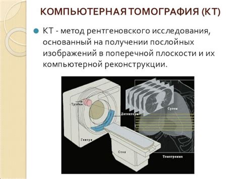 Методы и принципы изображения в КТ