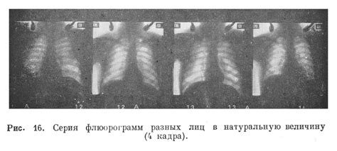 Методы и принципы изображения в флюорографии