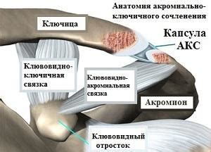 Методы лечения Акс 2 степени плечевого сустава